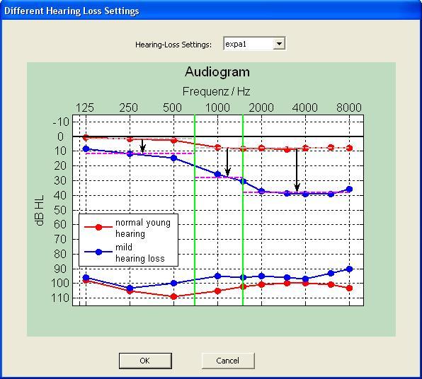 Hearing Assistence: Audiogram on Different Hearing Loss Settings